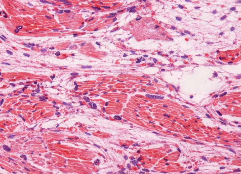 How leading-edge heart research is saving young lives 
